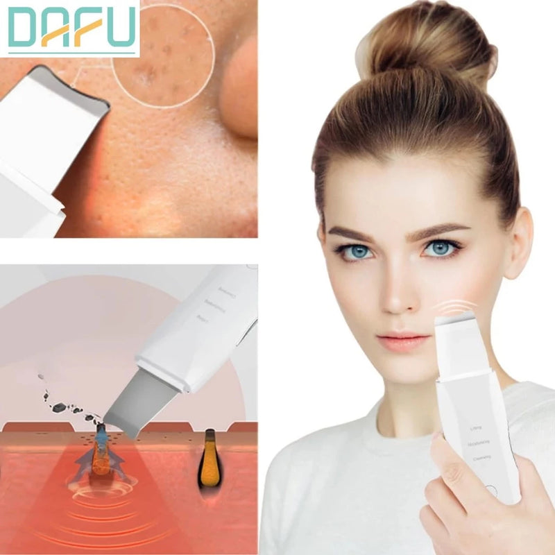 Aparelho de Peeling Esfoliante Ultrassônico Limpeza Facial Profunda Remoção de Cravos Antirrugas Sonic Skin Sonic Skin