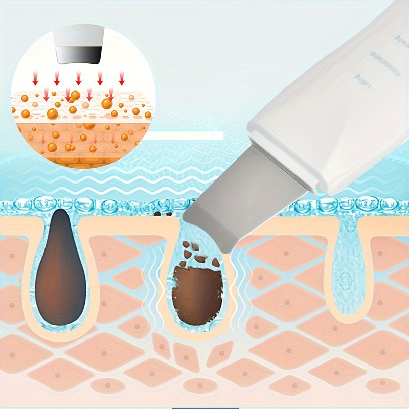 Aparelho de Peeling Esfoliante Ultrassônico Limpeza Facial Profunda Remoção de Cravos Antirrugas Sonic Skin Sonic Skin