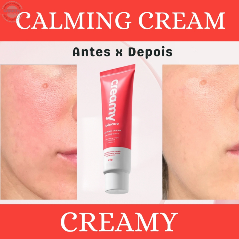 Creamy Calming Cream Creme Hidratante Facial 40g