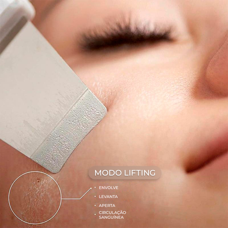 Aparelho de Peeling Esfoliante Ultrassônico Limpeza Facial Profunda Remoção de Cravos Antirrugas Sonic Skin Sonic Skin