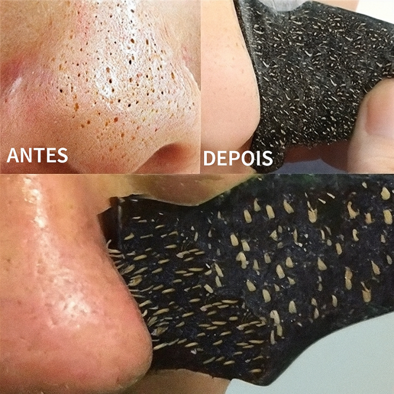  Adesivo Removedor de Cravos a Base de Carvão de Bambu Limpeza Profunda dos Poros ( kit com 10)
