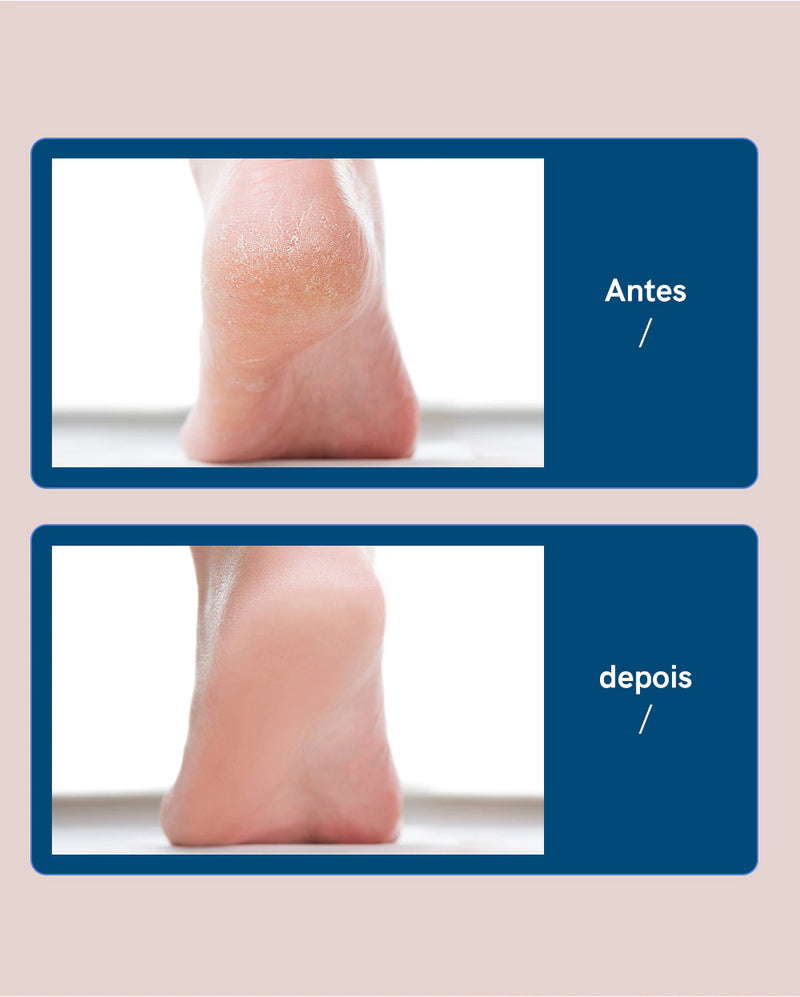 Lixa  Elétrica para os pés  e  Esfoliador